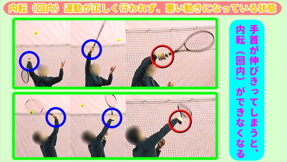 スピンサーブの内転(回内)が出来ない